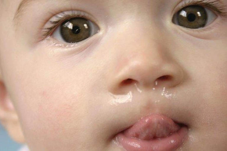 Trị chảy nước mũi chỉ với 1 vài động tác bấm huyệt